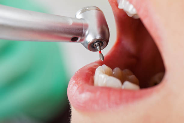 Best Emergency Treatment for Dental Infections or Abscesses in Prospect, KY